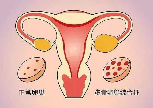 检查卵巢功能需要做什么检查 检查卵巢功能需要做什么检查