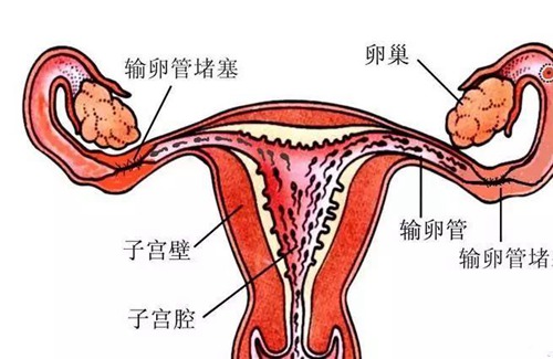 为什么会出现输卵管不通 为什么会出现输卵管不通