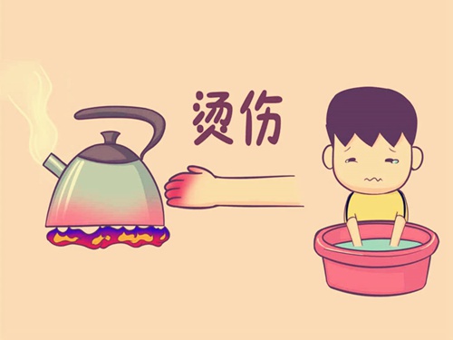 烫伤后第一时间怎么处理 烫伤后第一时间怎么处理