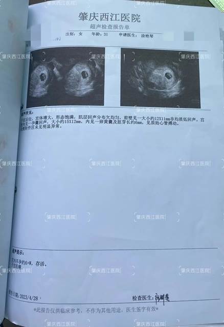 1687142162825309.jpg 图片
