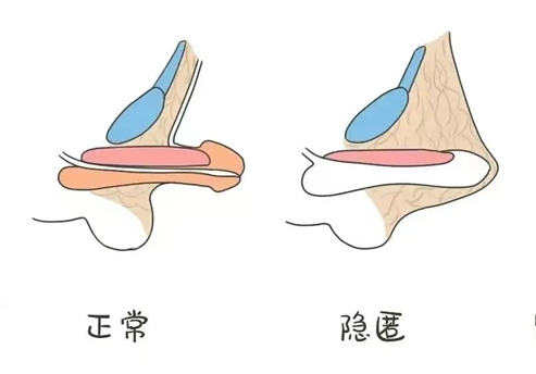 1687143246815746.png 图片