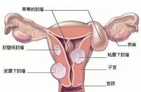 1687144745528423.png 图片