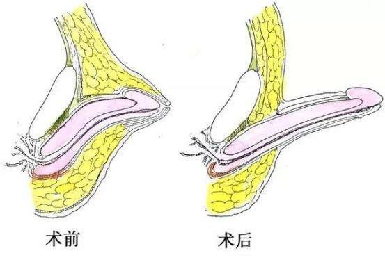1690342068143450.png 图片